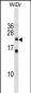 ISCU Antibody (C-term)